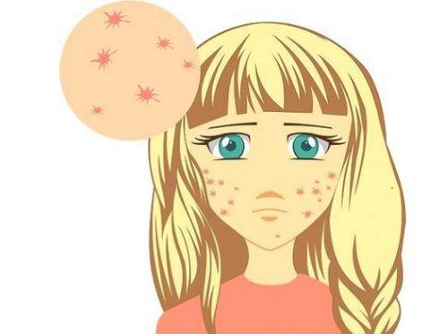 痤疮吃瓜,瓜类食物的神奇功效